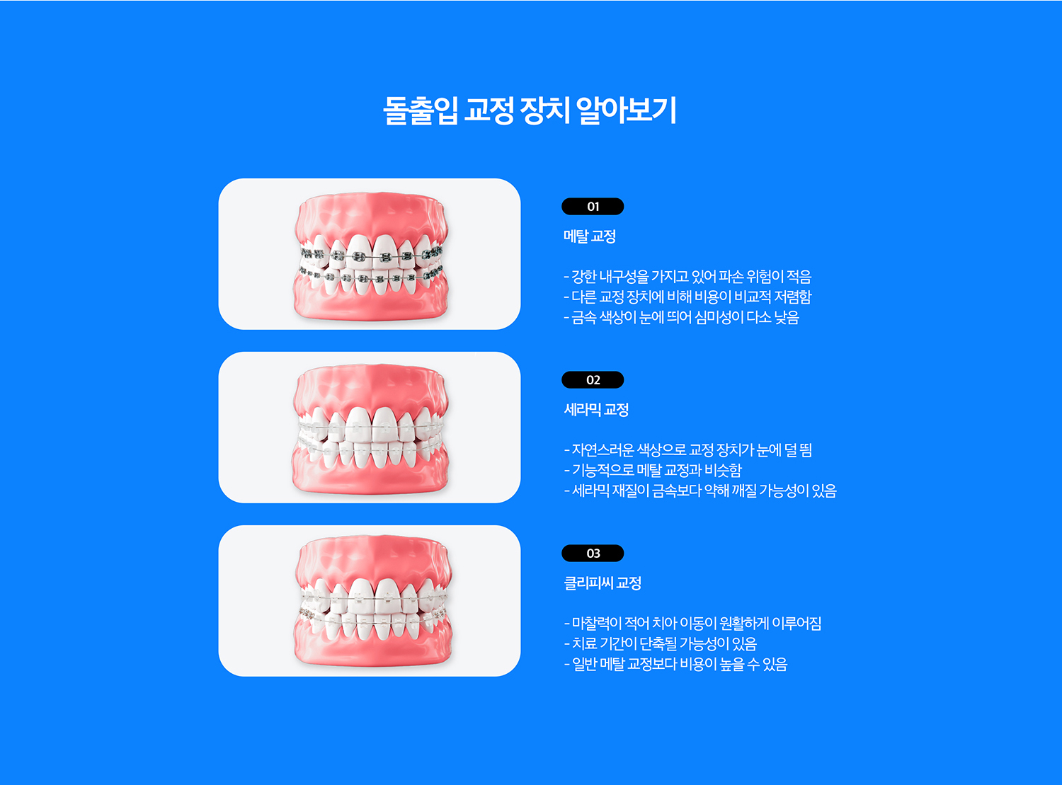 수원 돌출입교정 상세 안내 - 치료 과정 - 교정 진단 후 장치를 선택하고 배열, 공간 확보, 앞니 위치 조정, 교합 마무리 순서로 진행합니다. 치료 중에는 치아 이동과 잇몸·뿌리 상태를 정기적으로 확인합니다. / 치료 목표를 현실적으로 정합니다 - 치아 이동만으로 개선 가능한 범위와 골격적 요인이 큰 경우의 한계를 상담 단계에서 구분해야 합니다. 성인에서 턱뼈 자체의 위치 문제는 교정만으로 해결 가능한 범위가 제한될 수 있습니다.