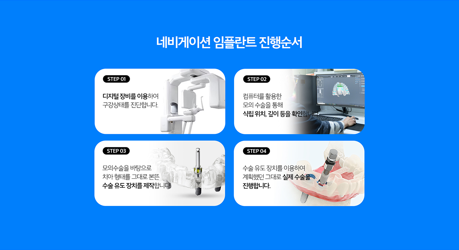 수원 네비게이션 임플란트 상세 안내 - 어떤 경우에 고려할 수 있나요? - 여러 개의 임플란트 위치를 체계적으로 계획해야 하거나 해부학적 구조를 피하면서 식립 방향을 세밀하게 검토해야 하는 경우, 보철 위치를 기준으로 수술계획을 세워야 하는 경우에 활용을 검토할 수 있습니다.
