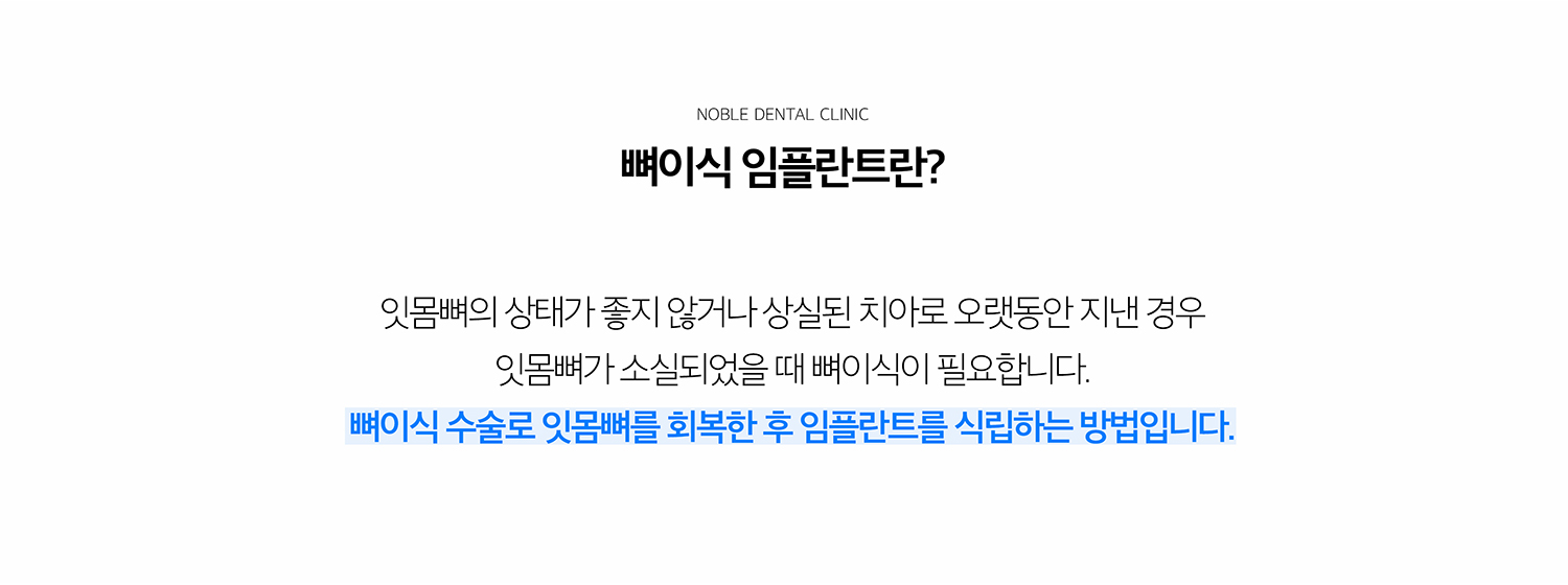 수원 뼈이식 임플란트 상세 안내 - 잇몸뼈는 왜 부족해질까요? - 치아를 잃은 뒤 오랜 시간이 지나거나 치주질환으로 뼈가 소실된 경우, 염증이 심했던 치아를 발치한 경우, 원래 뼈 폭이 좁은 경우 등 여러 원인으로 임플란트 부위의 뼈가 부족할 수 있습니다. / CT와 구강검사에서 확인하는 것 - 뼈의 폭과 높이, 결손 방향, 상악동과 신경관 위치, 주변 치아와 잇몸 상태를 확인합니다. 필요한 뼈의 양과 이식 범위를 추정한 뒤 임플란트와 동시에 진행할지 먼저 뼈이식을 할지 결정합니다.