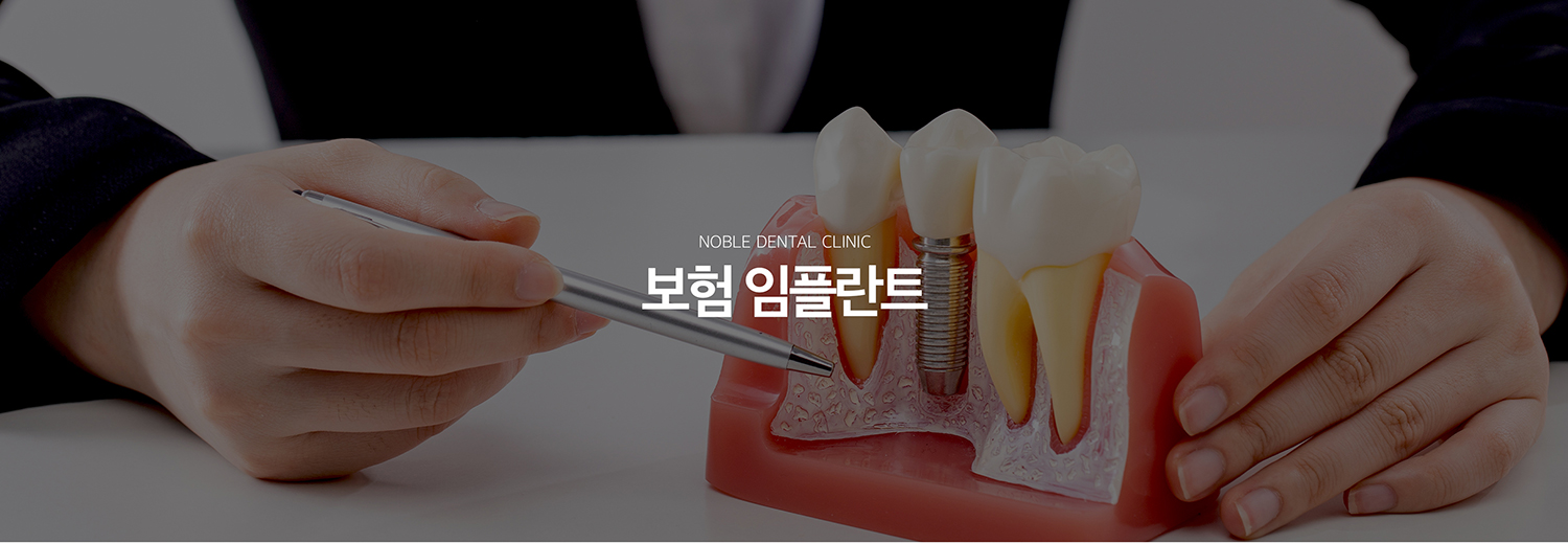 수원 건강보험 임플란트 대표 안내 - 건강보험 임플란트는 보험 기준을 충족하는 경우 정해진 절차에 따라 적용할 수 있습니다. 연령과 치아 상태, 과거 보험 임플란트 이용 이력 등 확인이 필요하며, 뼈이식과 같은 추가 치료는 별도 기준이 적용될 수 있어 상담 시 구분해 안내받는 것이 좋습니다.