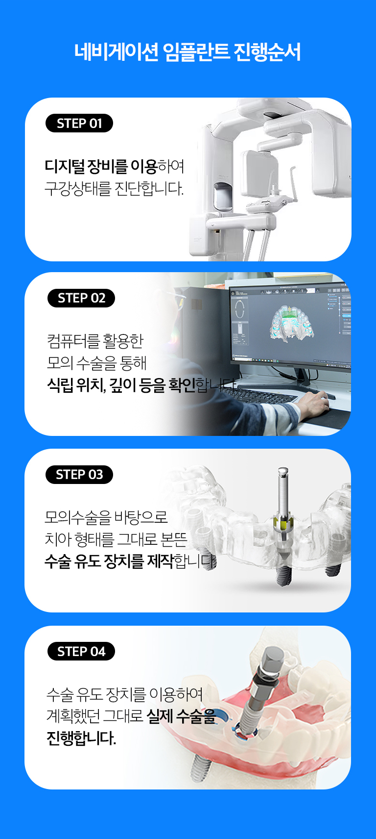 수원 네비게이션 임플란트 상세 안내 - 어떤 경우에 고려할 수 있나요? - 여러 개의 임플란트 위치를 체계적으로 계획해야 하거나 해부학적 구조를 피하면서 식립 방향을 세밀하게 검토해야 하는 경우, 보철 위치를 기준으로 수술계획을 세워야 하는 경우에 활용을 검토할 수 있습니다.