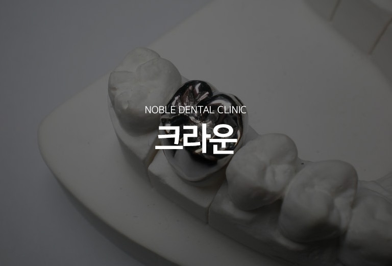 수원 크라운 치료 대표 안내 - 크라운은 치아가 크게 손상되었거나 신경치료 후 파절 위험이 높아진 경우 치아 전체를 덮어 형태와 기능을 회복하는 보철치료입니다. 남아 있는 치질의 양, 치아 위치, 교합, 잇몸 상태를 확인해 크라운이 필요한지 판단합니다.