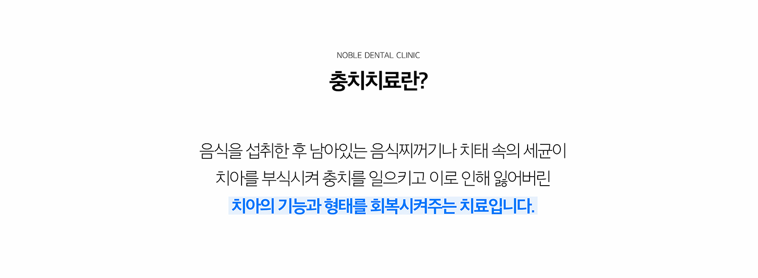 수원 충치치료 상세 안내 - 충치 진행 단계와 증상 - 초기 충치는 통증이 거의 없을 수 있고 상아질까지 진행하면 차갑거나 단 음식에 시릴 수 있습니다. 신경 가까이 진행되면 자발통이나 오래 지속되는 통증이 나타날 수 있습니다. / 검사에서 확인하는 내용 - 육안검사와 방사선 자료, 충치 범위와 치아 파절 여부를 확인합니다. 기존 충전물 아래 재충치나 치아 사이 충치는 겉으로 잘 보이지 않을 수 있습니다.